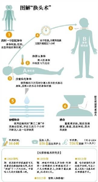 人头移植（新型医疗技术）
