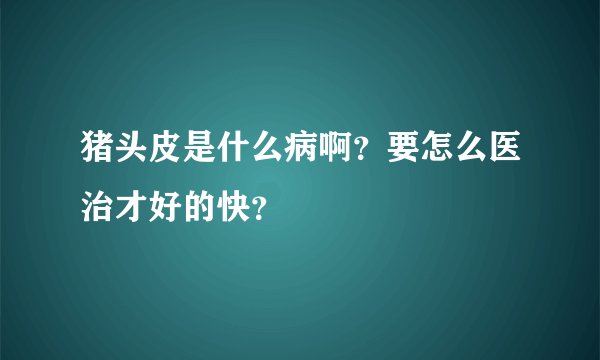 猪头皮是什么病啊?要怎么医治才好的快?