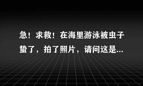 急！求救！在海里游泳被虫子蛰了，拍了照片，请问这是什么虫子？有毒吗？