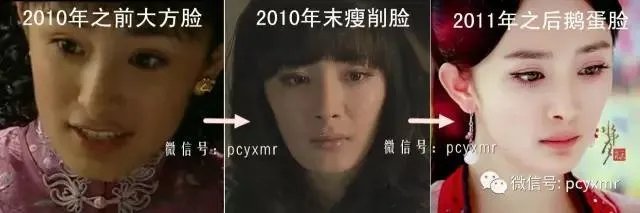 拔智齿真的可以瘦脸吗?有何依据?