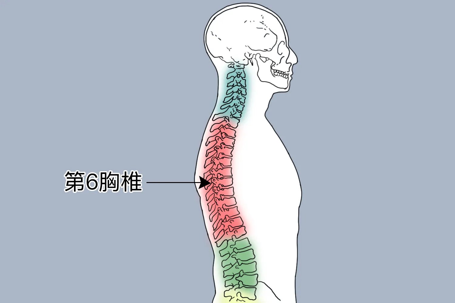 T6椎体位置图