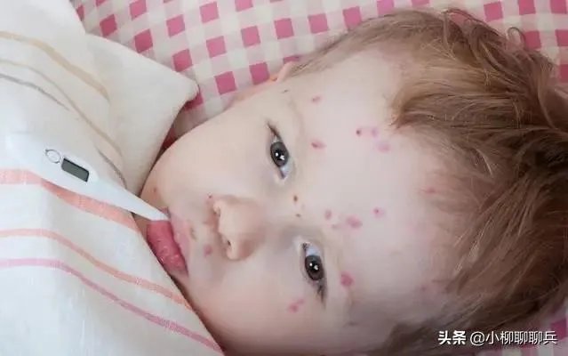 如何看待英国多个重症监护病房儿童身上出现罕见病,是新冠出现变异了么?