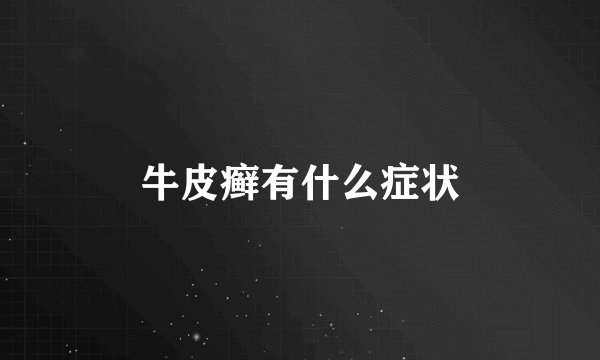 牛皮癣有什么症状
