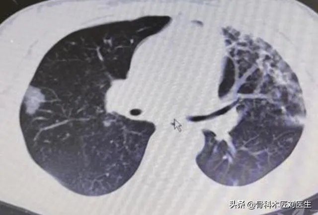 谁能解释一下昨天19号湖北省的新增病例统计是如何计算的,一头雾水?