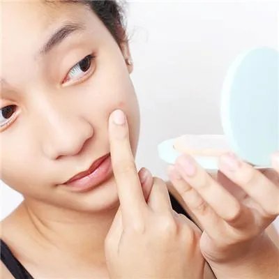 治疗青春痘家医院最好 怎样治疗青春痘?