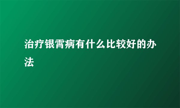 治疗银霄病有什么比较好的办法