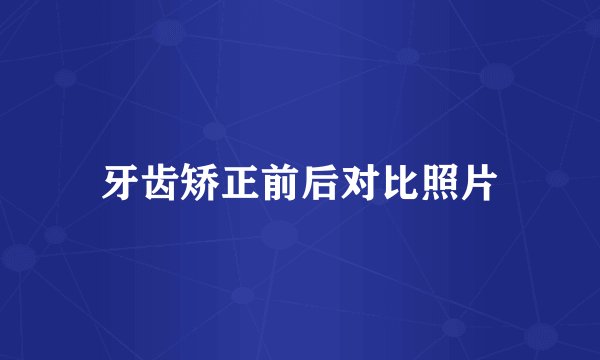 牙齿矫正前后对比照片
