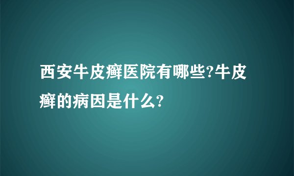 西安牛皮癣医院有哪些?牛皮癣的病因是什么?