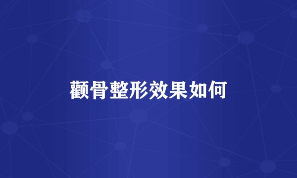 颧骨整形效果如何