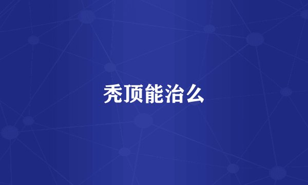 秃顶能治么