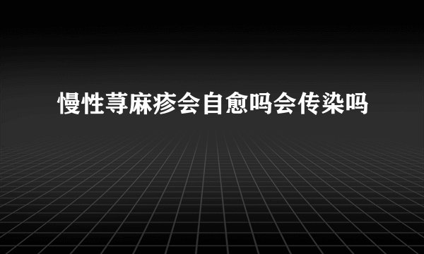 慢性荨麻疹会自愈吗会传染吗