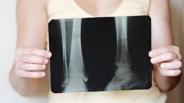 骨龄比实际年龄大是怎么回事