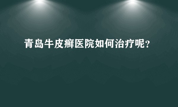 青岛牛皮癣医院如何治疗呢？