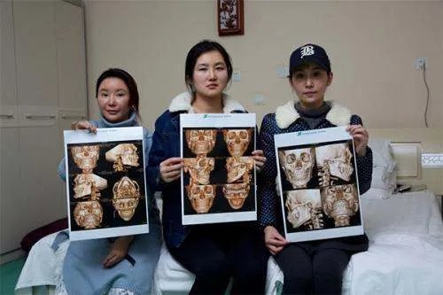 韩国整形业幽灵手术遭曝光是怎么回事?