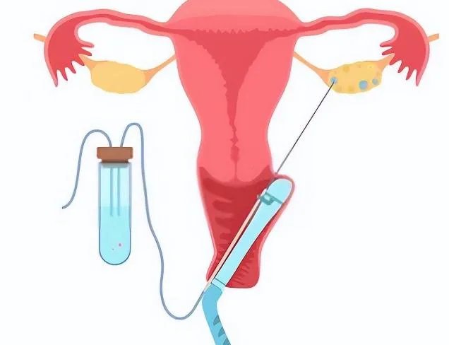西安试管代生-陕西省妇幼保健院第三代试管婴儿费用明细,2023年第三代捐卵价格表