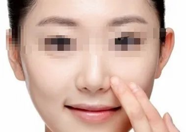杭州哪个医院做垫鼻梁整形比较好?究竟需要多少费用呢