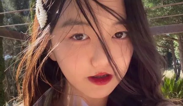 王菲女儿李嫣术后治疗好兔唇,长得像年轻王菲,惊艳众人,你认为呢?