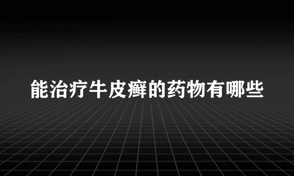 能治疗牛皮癣的药物有哪些