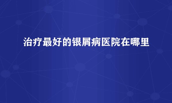 治疗最好的银屑病医院在哪里