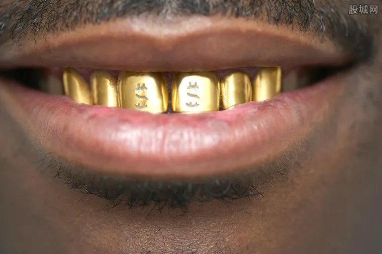镶金牙检测不含金 在牙医诊所镶金牙多少钱?