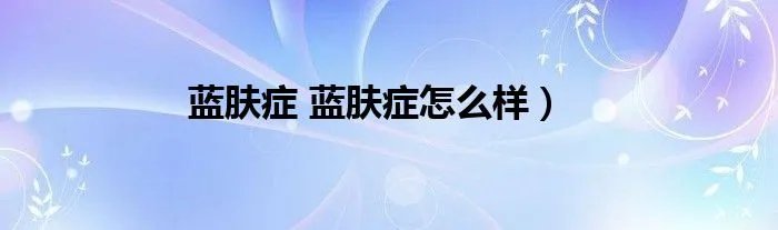 蓝肤症 蓝肤症怎么样）