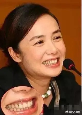 明星尴尬