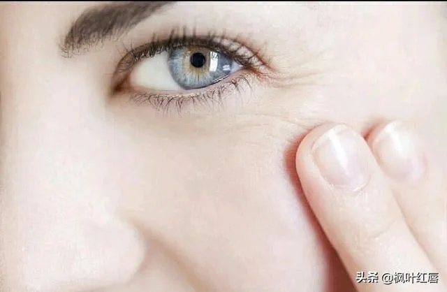 请问眼贴以及眼霜使用后细纹增多有可能是什么原因导致的?