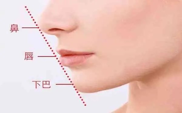 整下巴多少钱